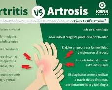 artrosis y artritis